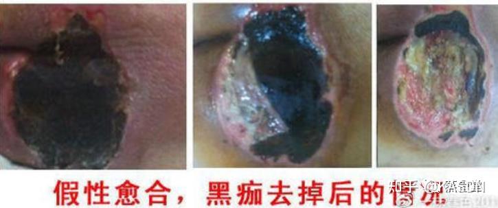 1775274462113890.jpg v2-24a3eb92225d846c62d7bd65086687fc_1440w.jpg