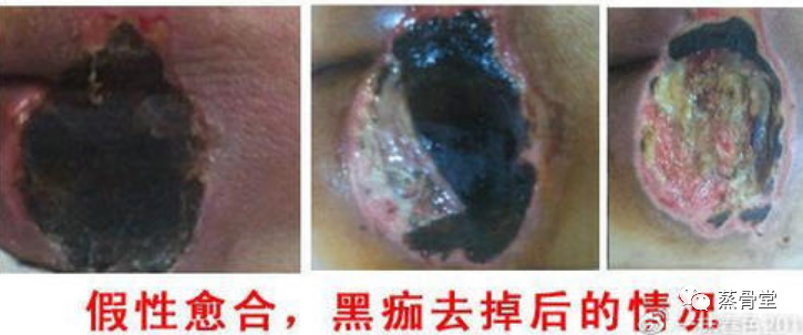 1775893452198237.png 869d27bedcd285909600d15f927ca566_640_wx_fmt=png.png