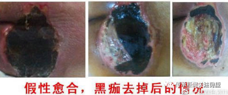 1775893727833313.png b2ccc16bfe6caa46096dd9b3a23b5ae1_640_wx_fmt=png.png